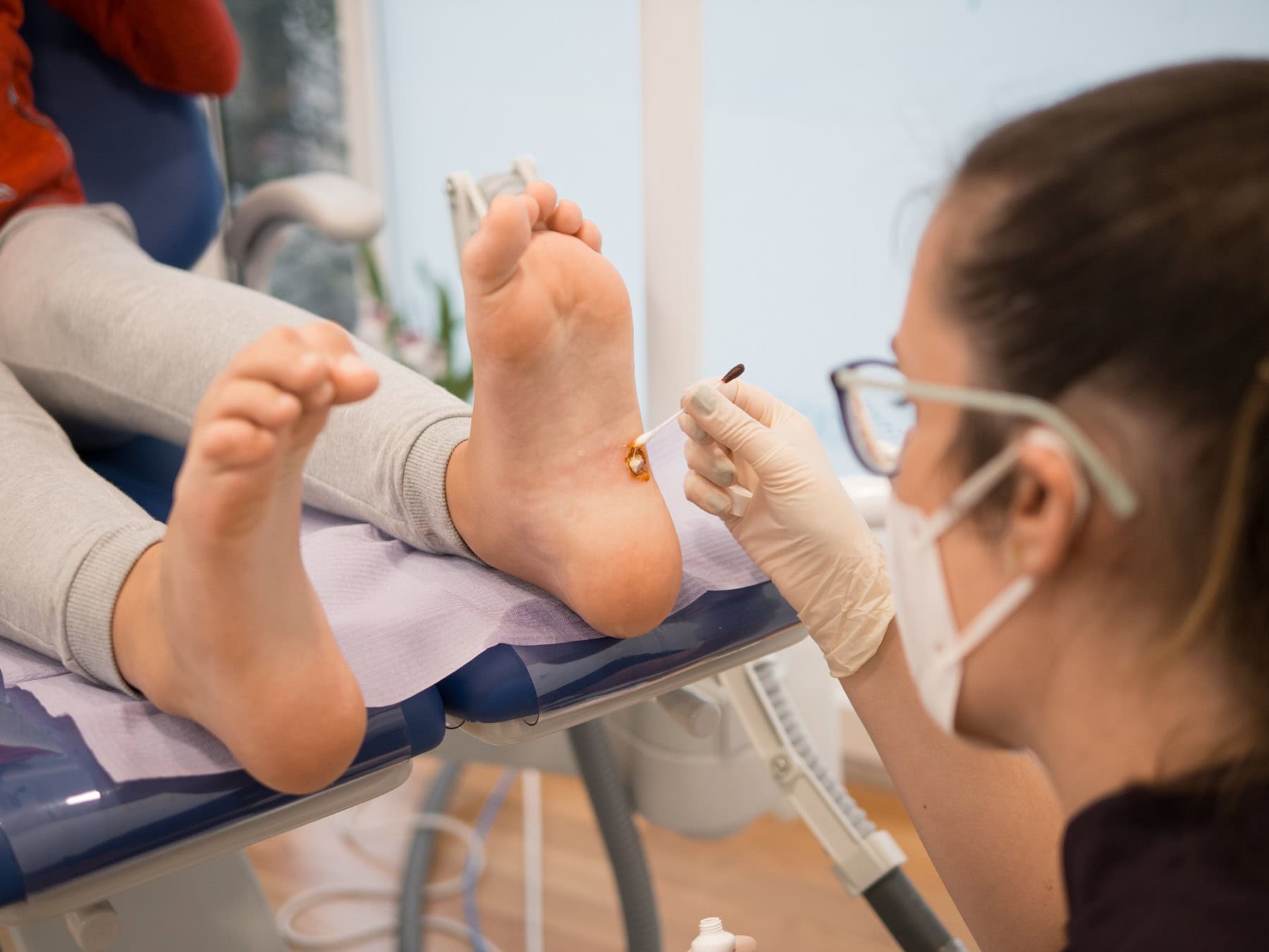 Children and Plantar Warts
