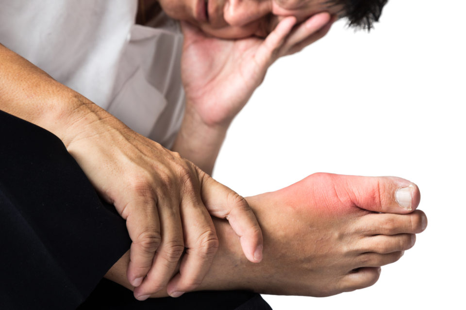 What Are Bunions and How To Treat Your Big Toe Pain