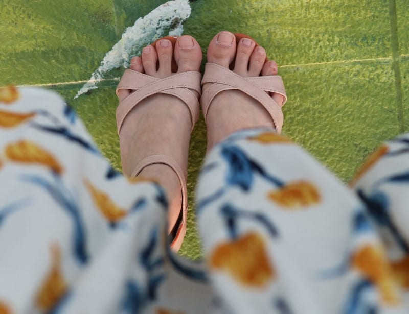 Bunion Pain – Gone!