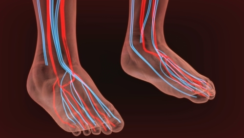 nerve pain