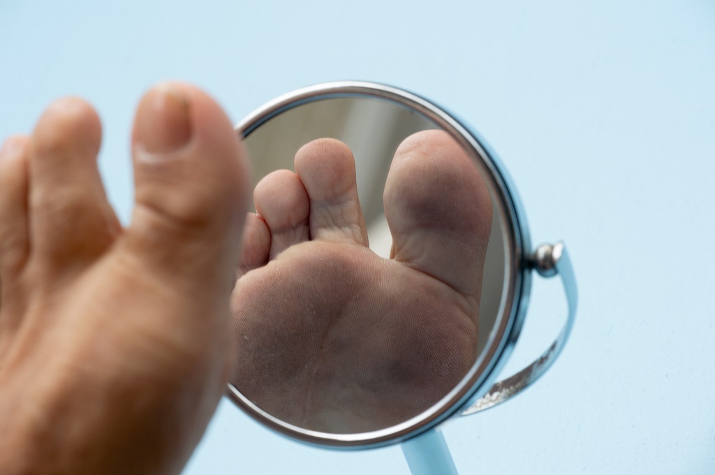 Diabetic Foot Care: Important Steps to Follow.