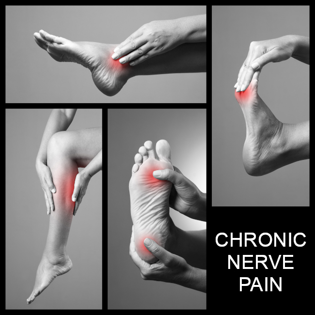 Does healthcare have it wrong when it comes to chronic nerve pain?