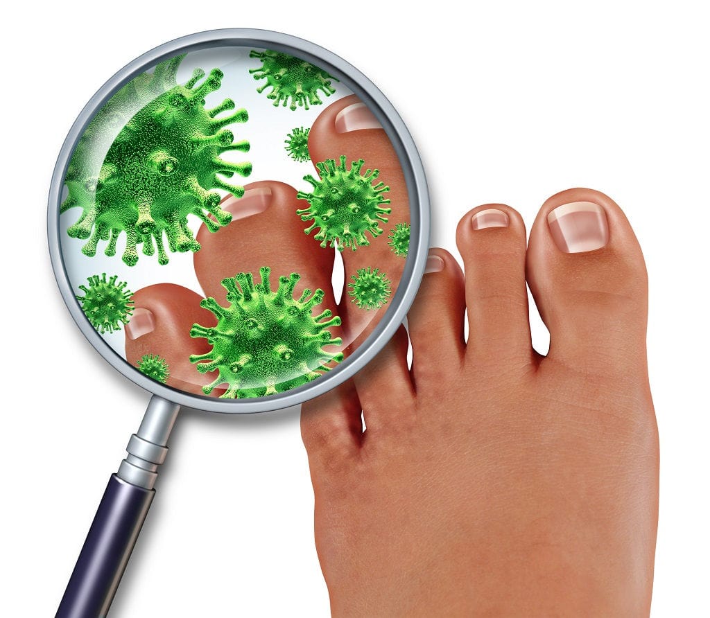 Athlete’s Foot Treatment: Nine things to do before you call your doctor