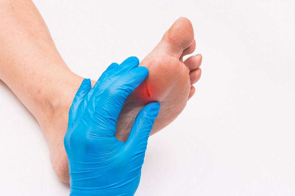 The three things you need to know about diabetic foot amputation