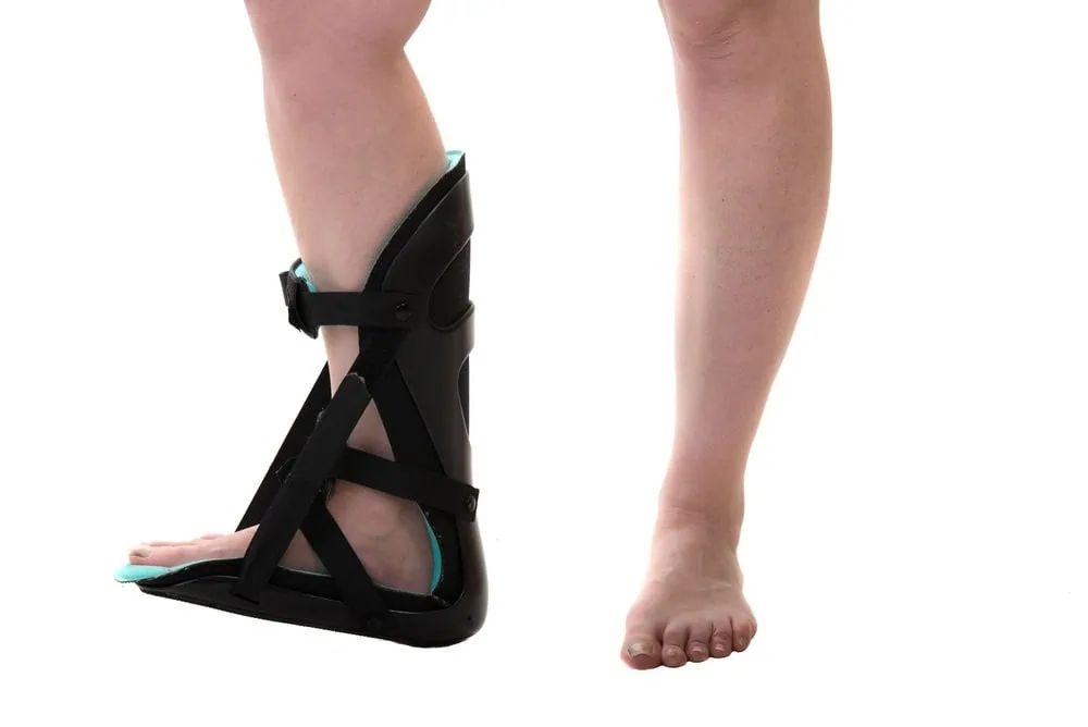 Effective Treatments for Drop Foot: Options and Solutions