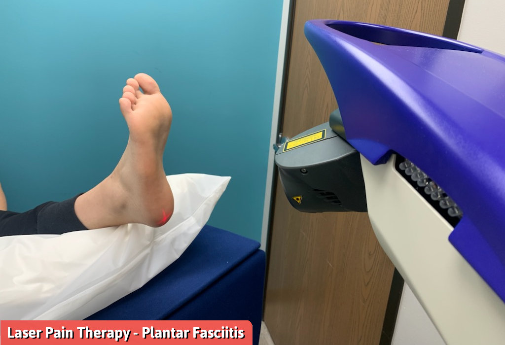 Understanding How Laser Therapy For Plantar Fasciitis Works! Is It Right For You?