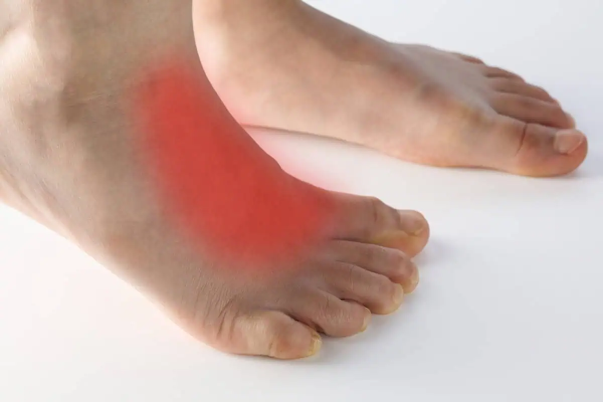 Have arthritis pain on the top of your foot? How we avoid joint fusion surgery.