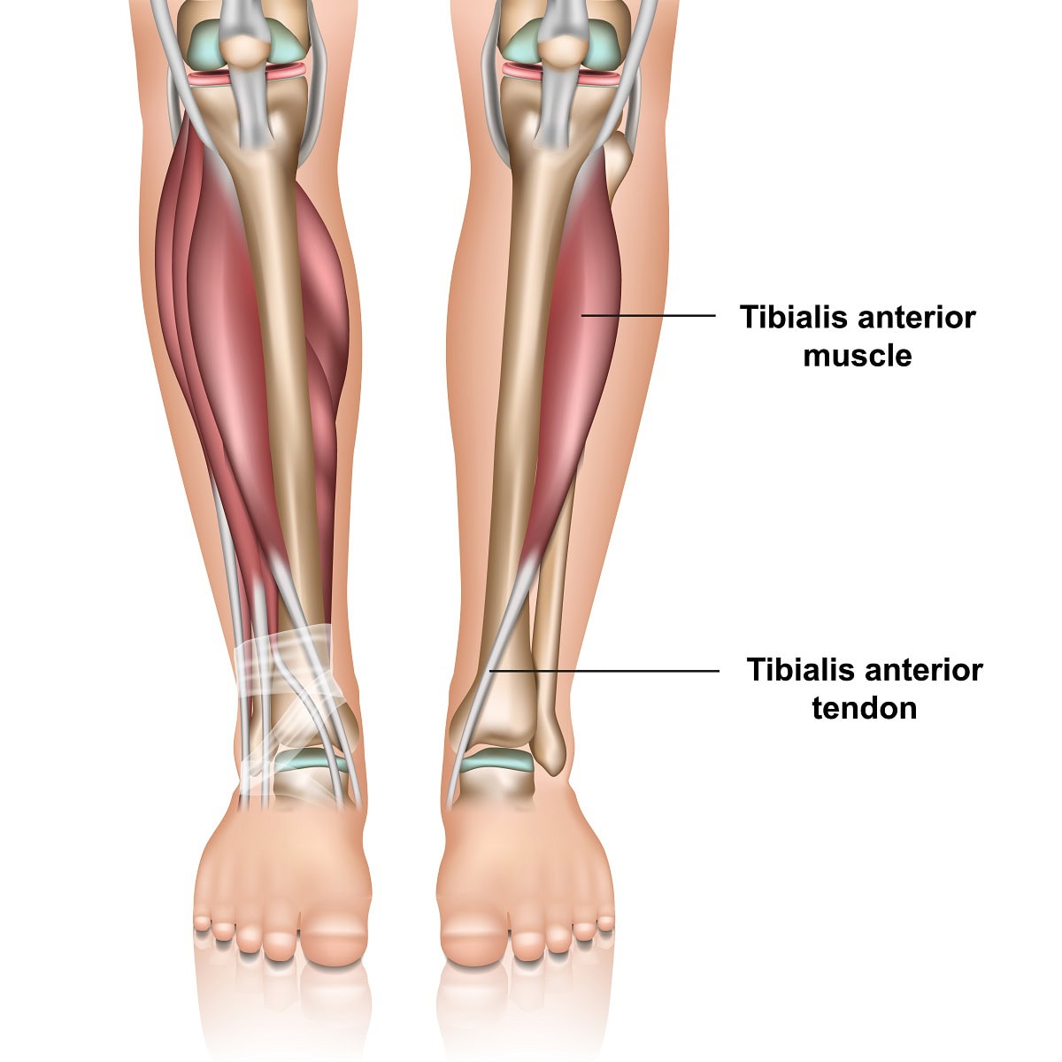 Tibialis Anterior Tendonitis: Symptoms and Treatment Options