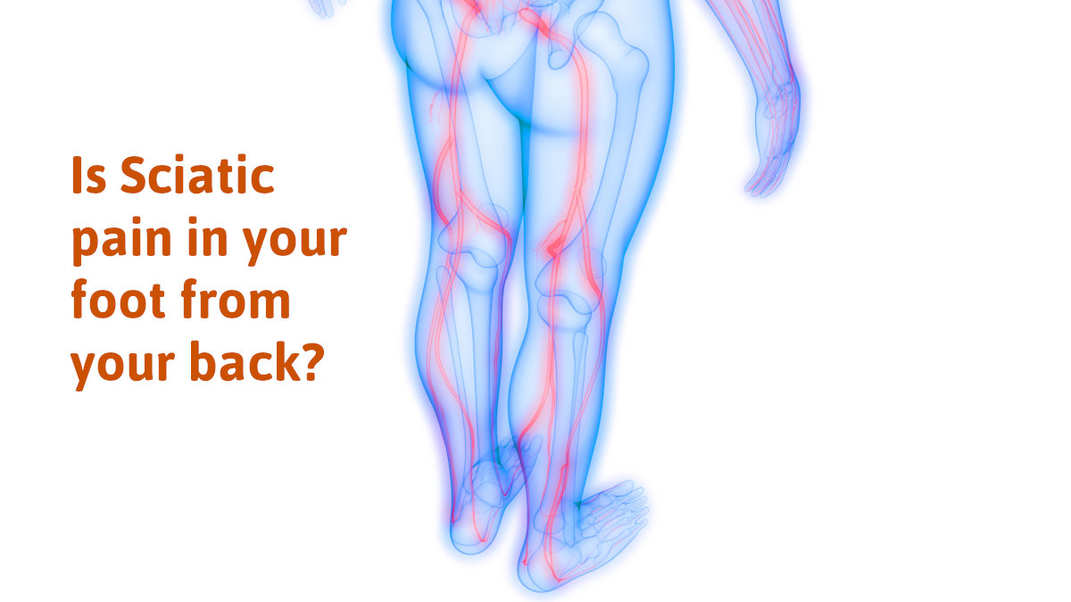 Is Sciatica Pain In Your Foot From Your Back? Wrong, Here’s Another Cause