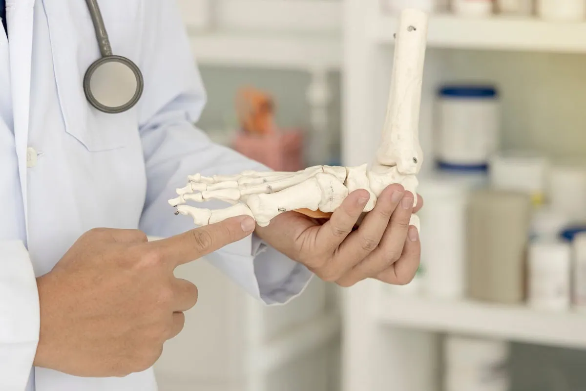 Bunion Surgery Recovery: A Complete Week-by-Week Breakdown