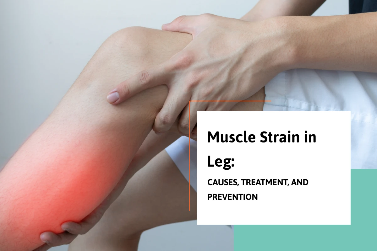 Muscle Strain in Leg: Causes, Treatment, and Prevention
