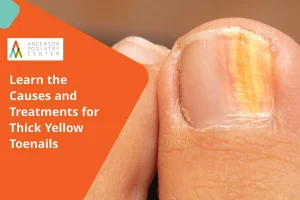 Learn the Causes and Treatments for Thick Yellow Toenails