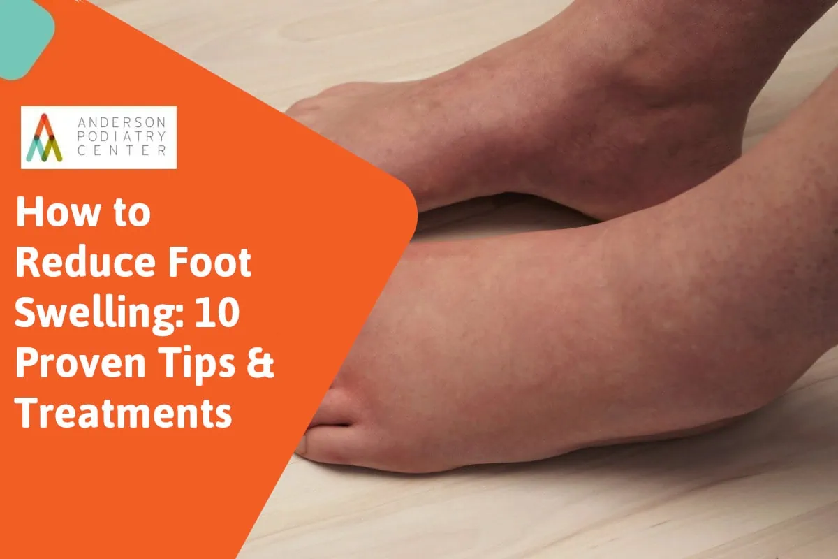 How to reduce foot swelling Edema